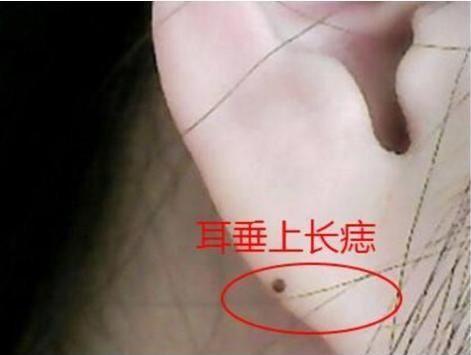 不能轻视!身体这处越多毛,未来命越好,绝对富贵!