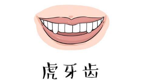 牙齿长这样的男女最好运,一世尽享荣华富贵!